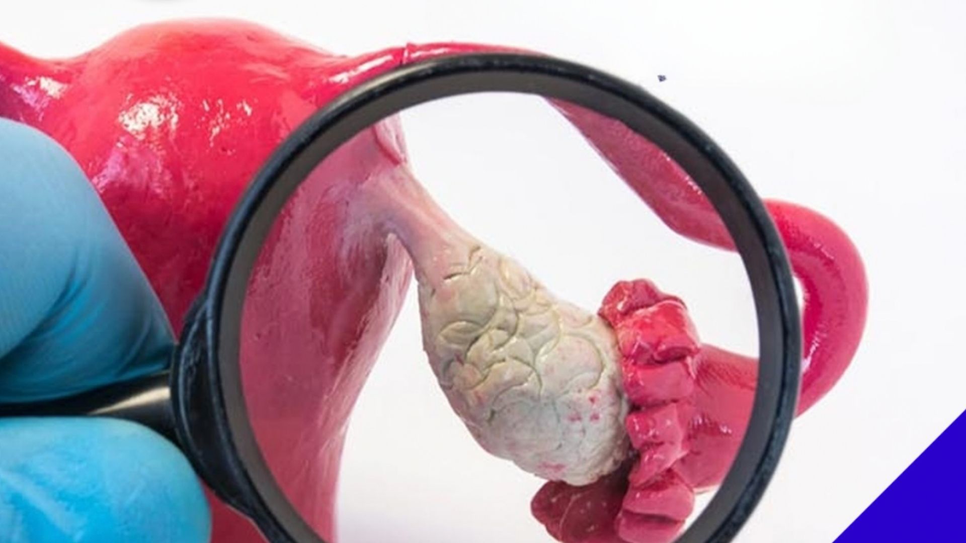 Hamile Kalma Şansı Ne Zaman En Yüksektir? – Prof. Dr. Özlem SEÇİLMİŞ Anlatıyor