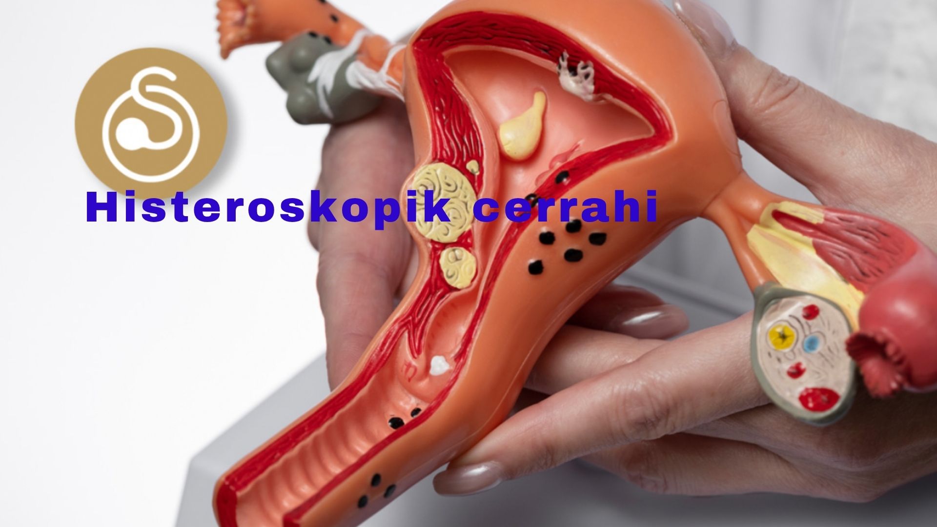 Histeroskopik Jinekolojik Cerrahi